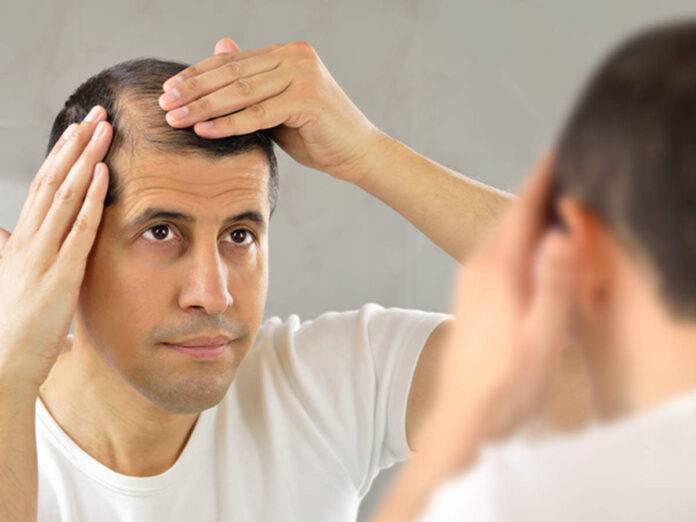 Is India An Effective Hair Transplants Destination